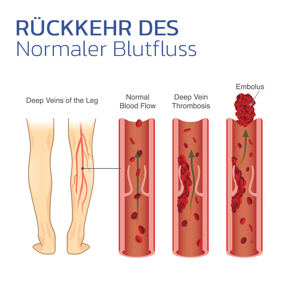 SenseVeines™ Thermotherapeutische Socke